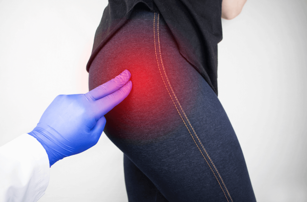 Sciatica And Leg Pain  Cause  Best Treatment Options