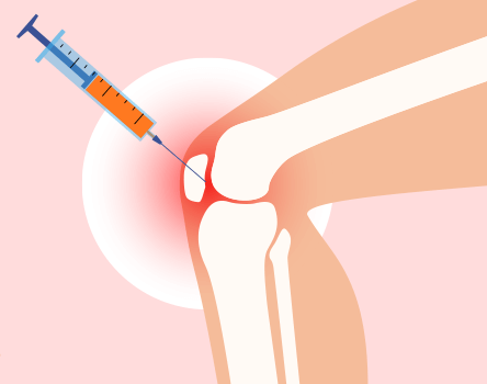 Knee Injection