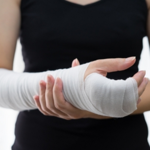 Fractures-Physioplus-Health-Group-Toronto-On