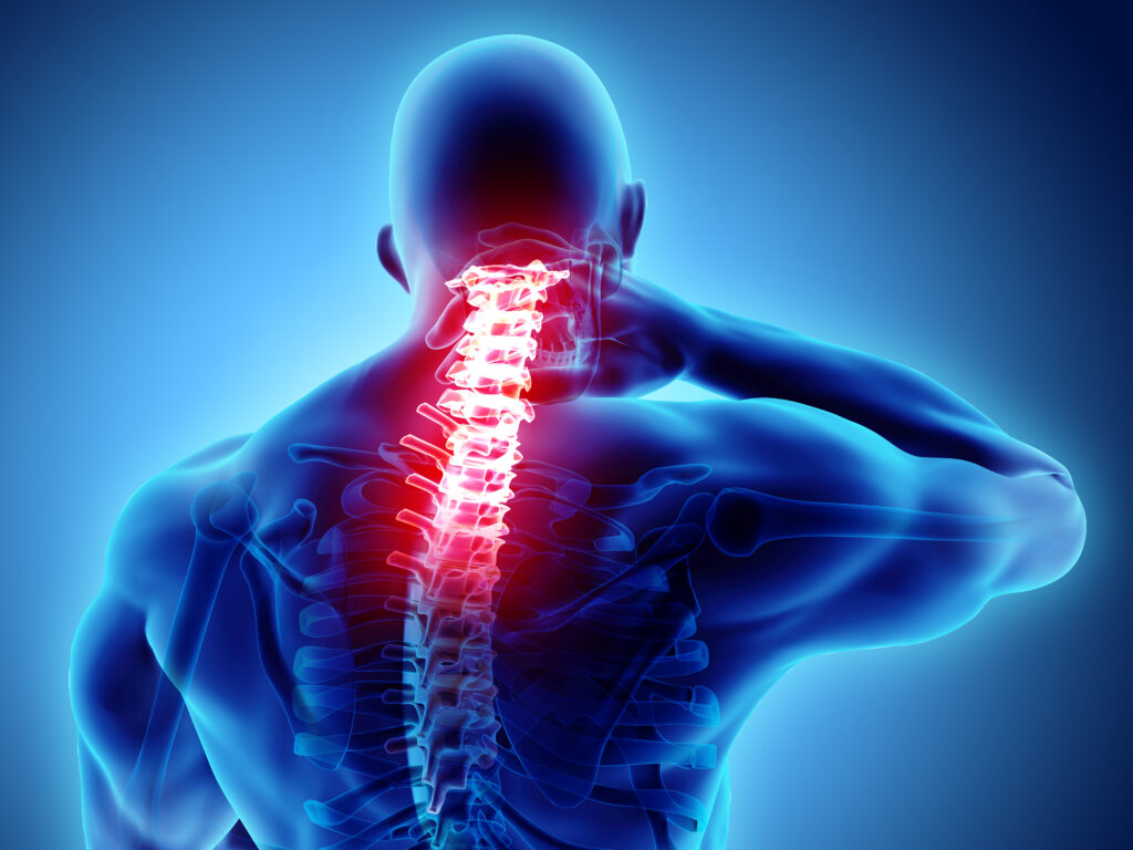 Are You Living With Neck Pain?