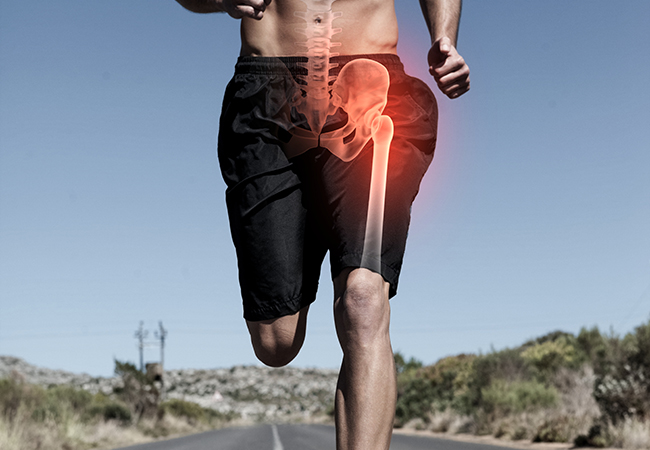 The Connection Between Hip and Knee Pain