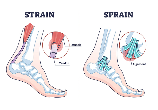 How Physiotherapy Can Help You Stay Active and Injury-Free
